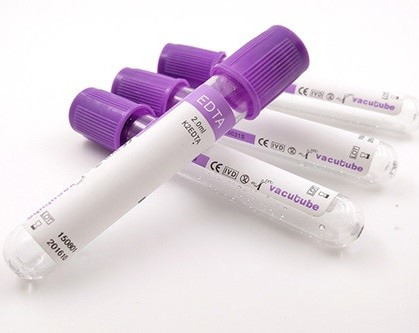 Tubo do EDTA de JINGZ 0.5ml-10ml K2 para o vácuo da análise de sangue de acordo com a altura